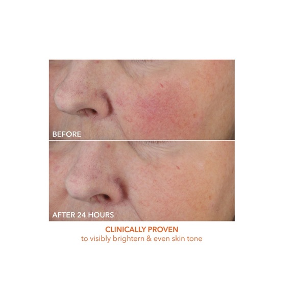 Dr Dennis Gross C + Collagen Deep Cream 1.7 - Picture 2 of 4